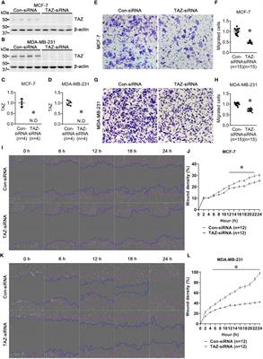 TAZ is involved in breast cancer cell migration via regulating actin dynamics